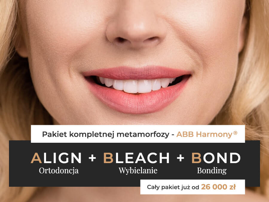 ABB Harmony® - Ortodoncja + Wybielanie zębów + Bonding