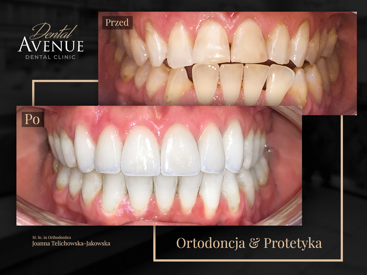 klinika ortodontyczna metamorfoza uśmiechu zębów