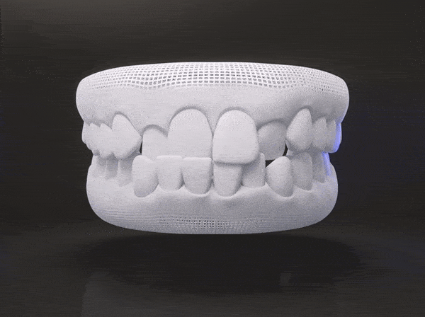 Skan 3D zębów invisalign